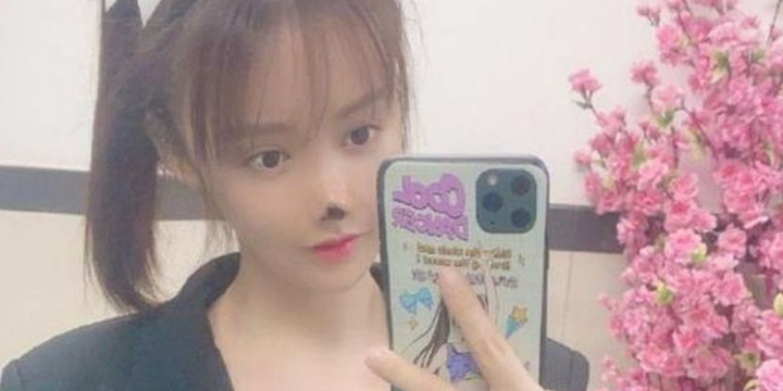 Chinese actress disfigured after nose surgery